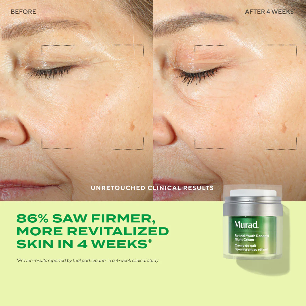 Retinol Youth Renewal Night Cream - Image 4