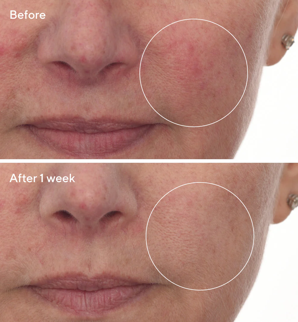 Cellular Hydration Barrier Repair Serum Refill - Image 4