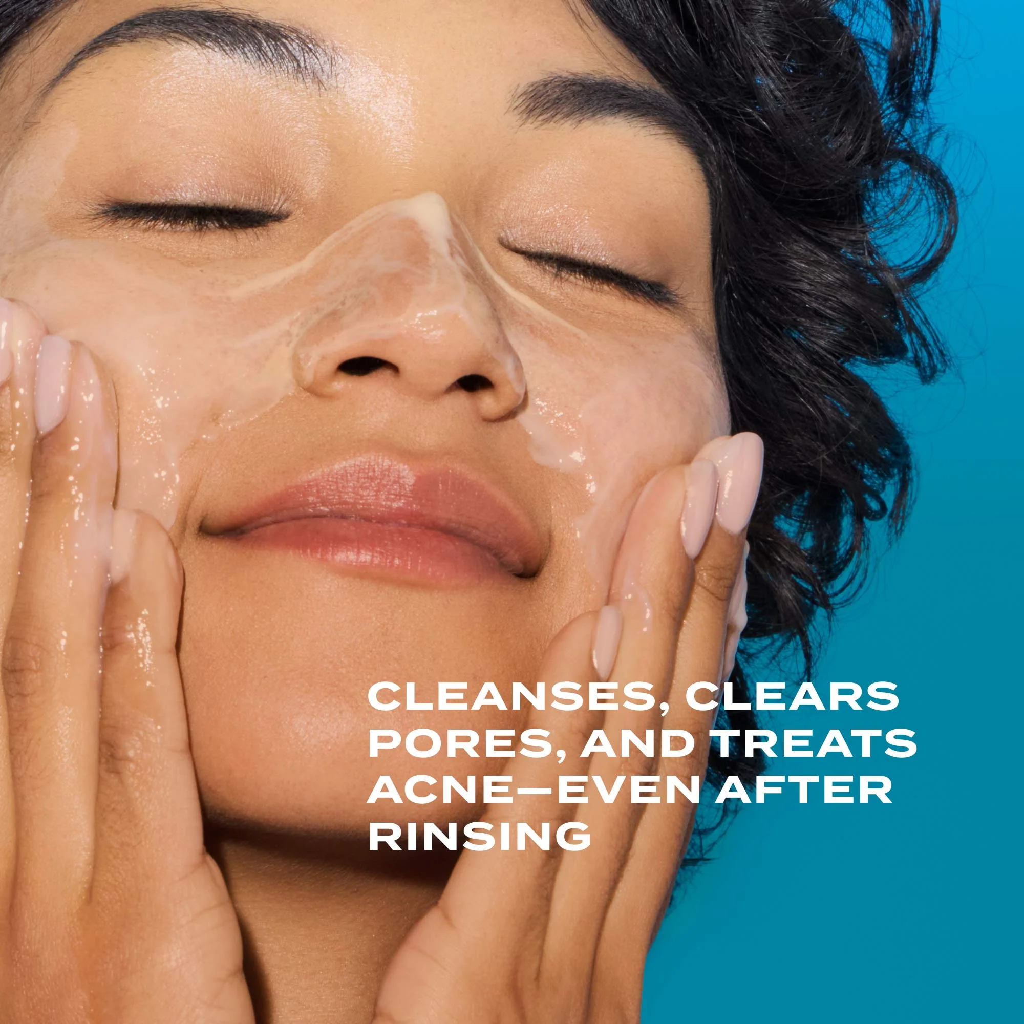 Acne Control Clarifying Cleanser - Image 3