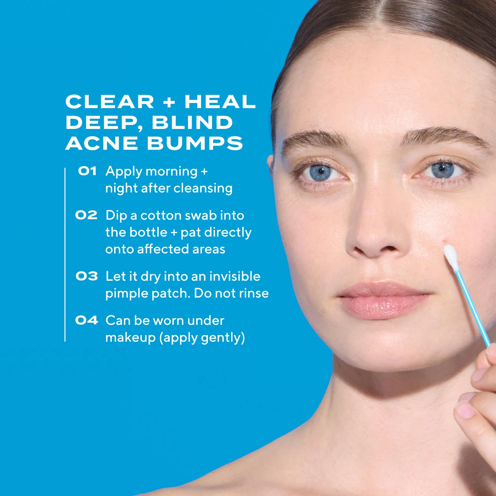 Deep Relief Acne Treatment - Image 8