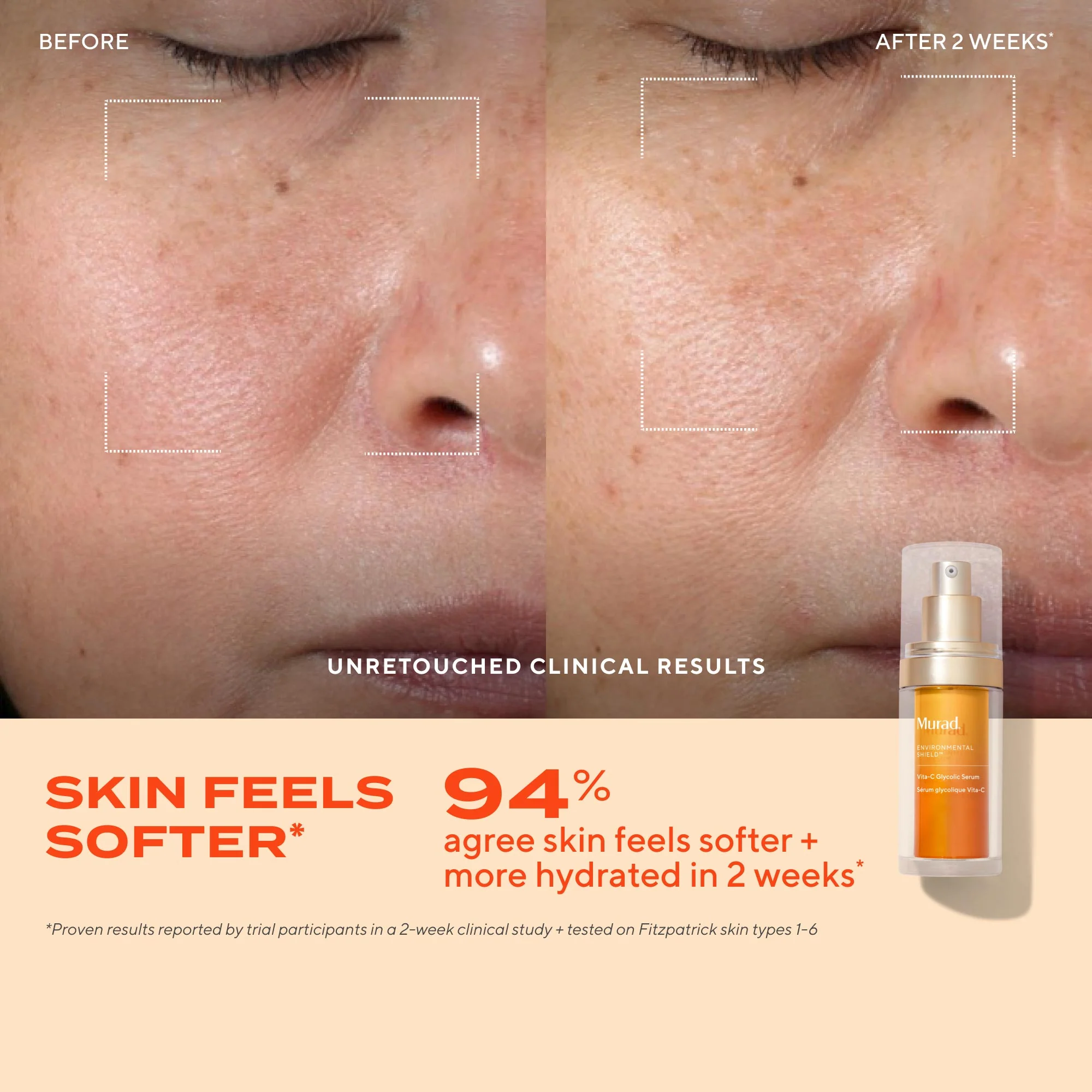 Vita-C Glycolic Serum - Image 4