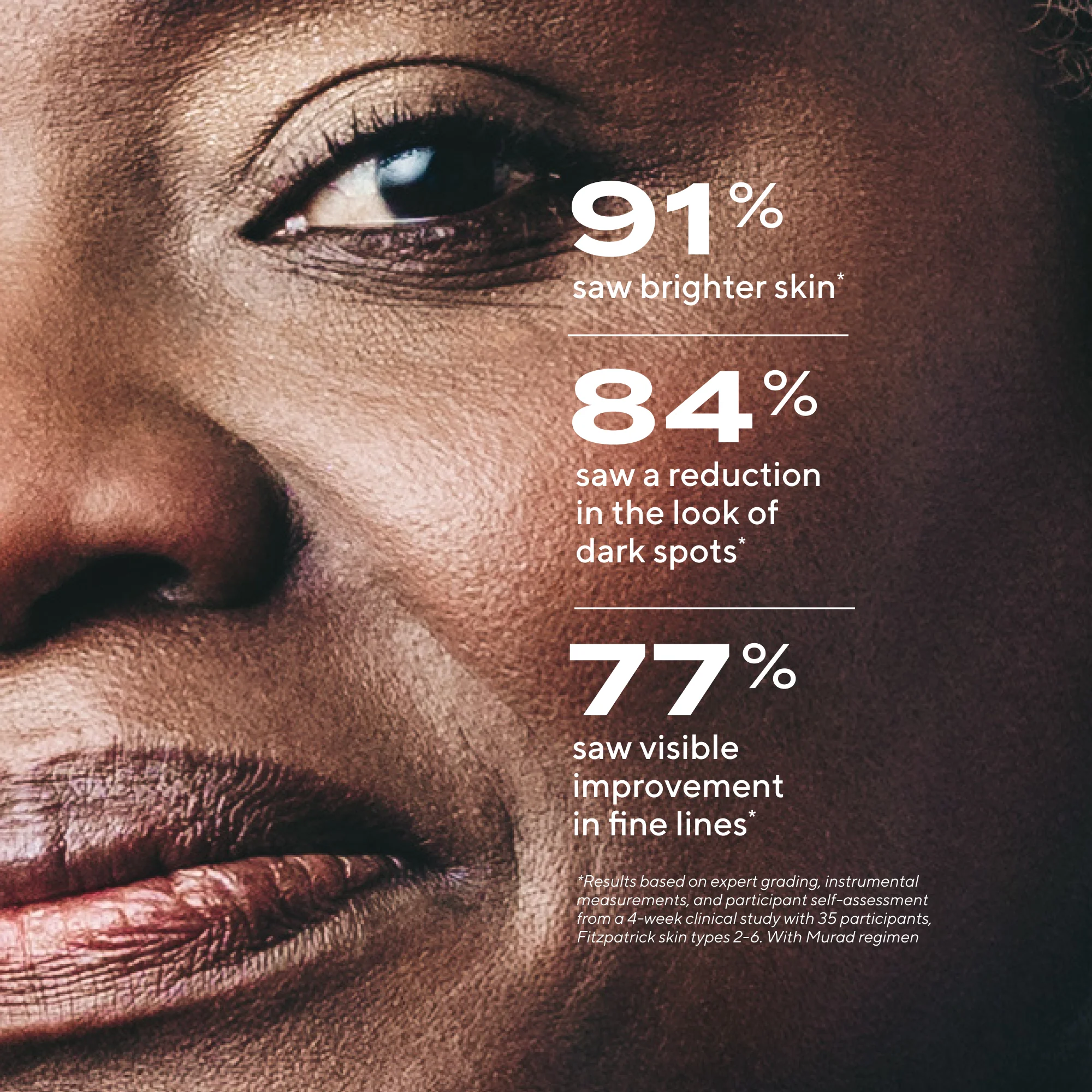 Rapid Dark Spot Correcting Serum - Image 3