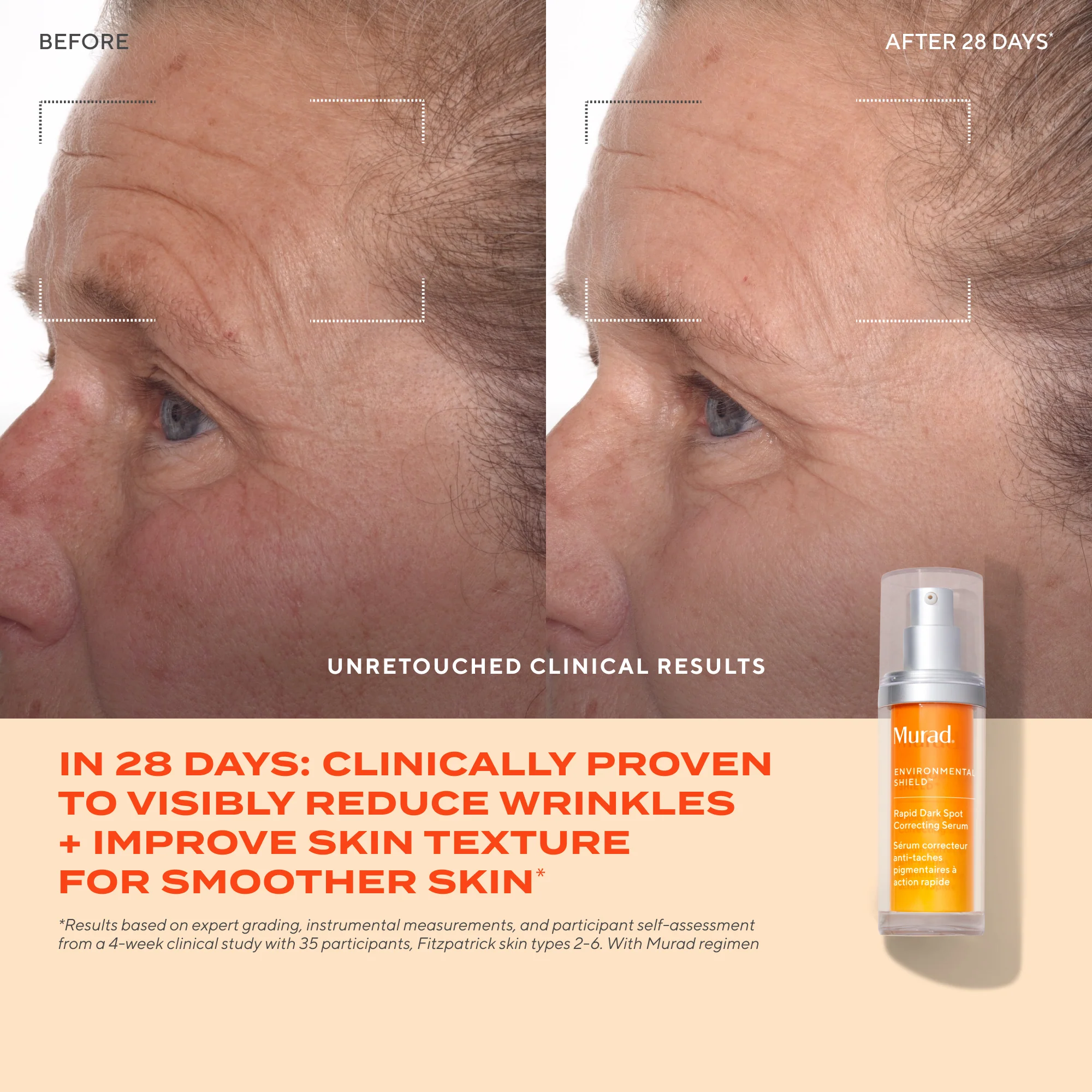 Rapid Dark Spot Correcting Serum - Image 5