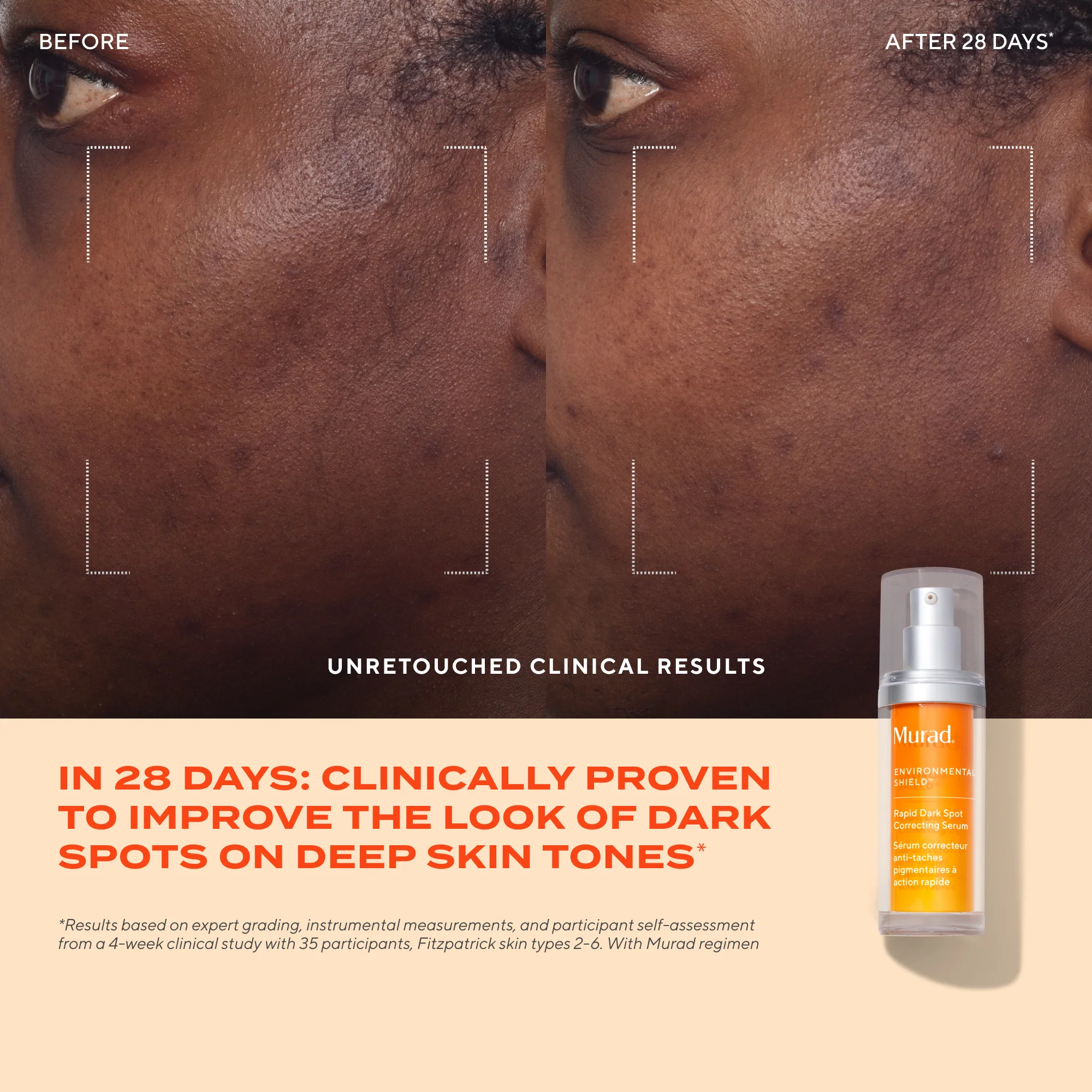 Rapid Dark Spot Correcting Serum - Image 6