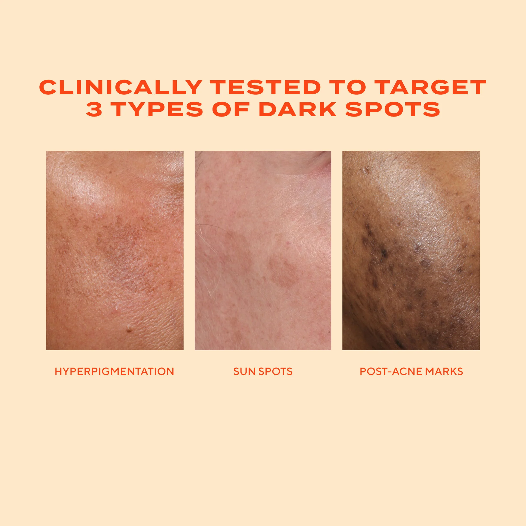 Rapid Dark Spot Correcting Serum - Image 8