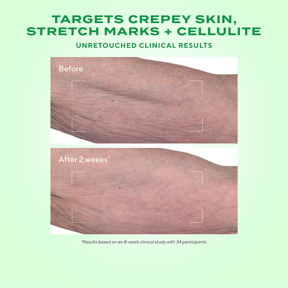 Retinal ReSculpt Body Treatment - Image 3