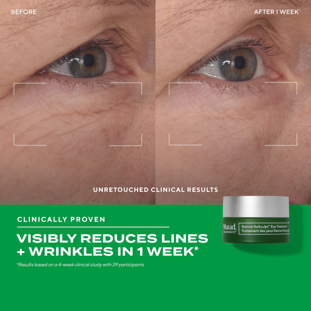 Retinal ReSculpt Eye Lift Treatment - Image 4