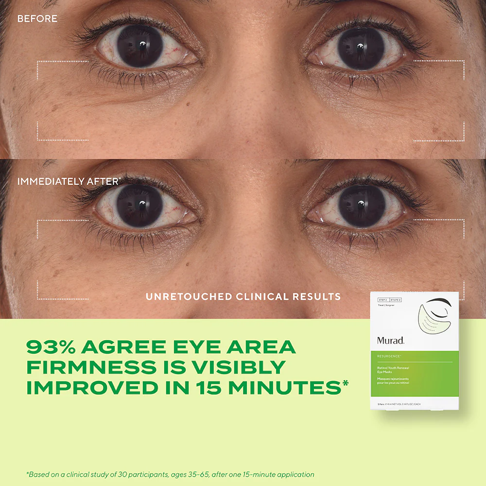 Retinol Youth Renewal Eye Masks - Image 4