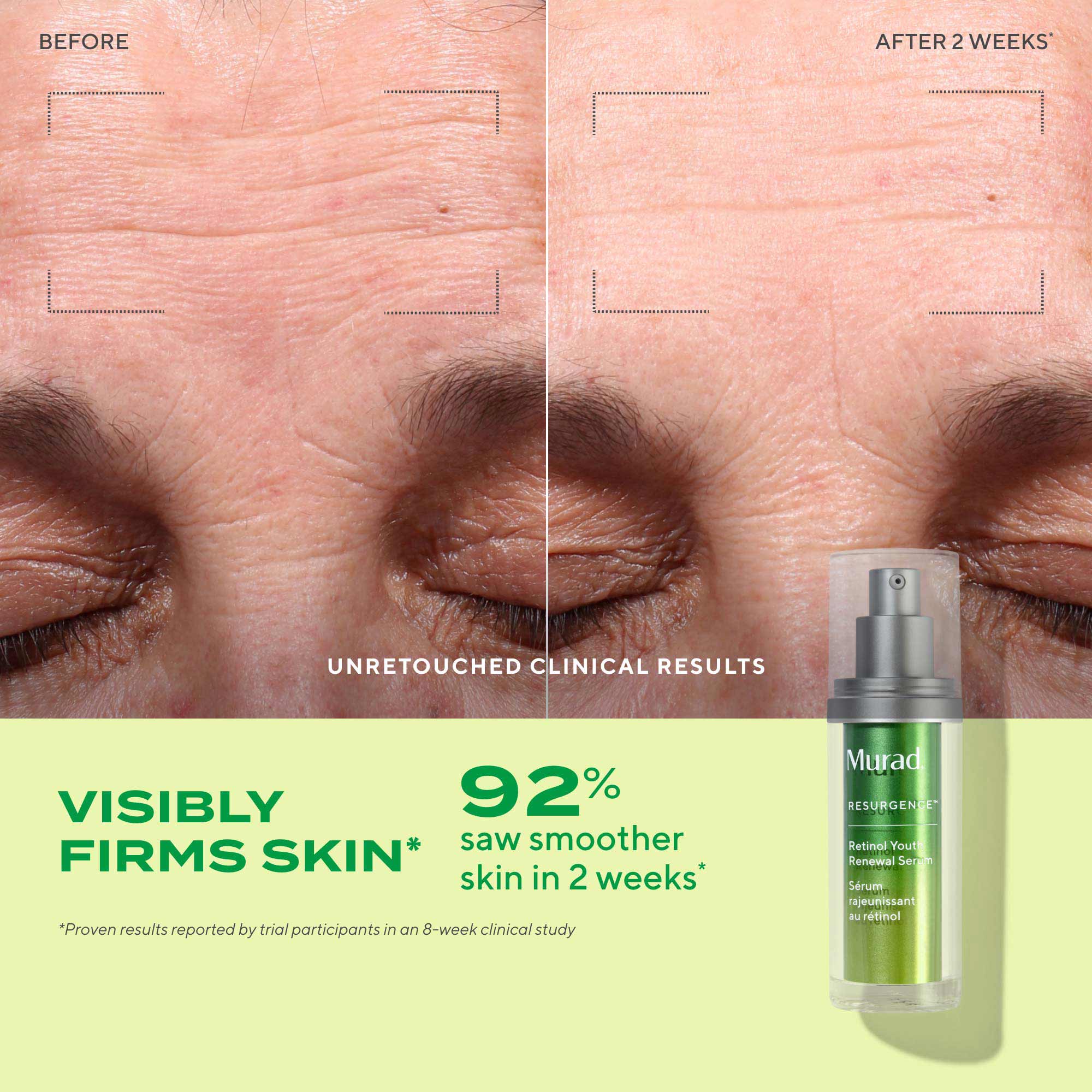 Retinol Youth Renewal Serum - Image 3