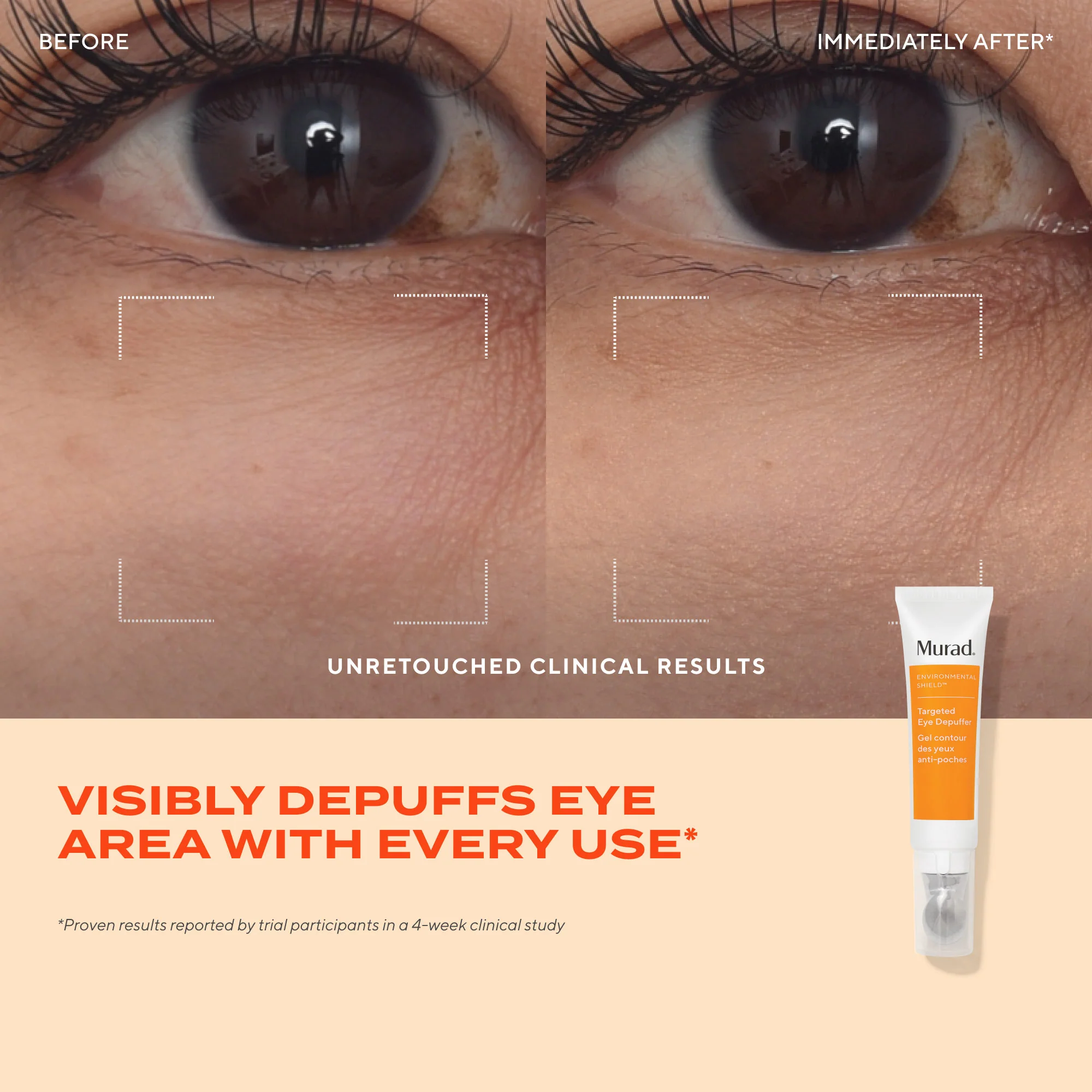 Targeted Eye Depuffer - Image 3