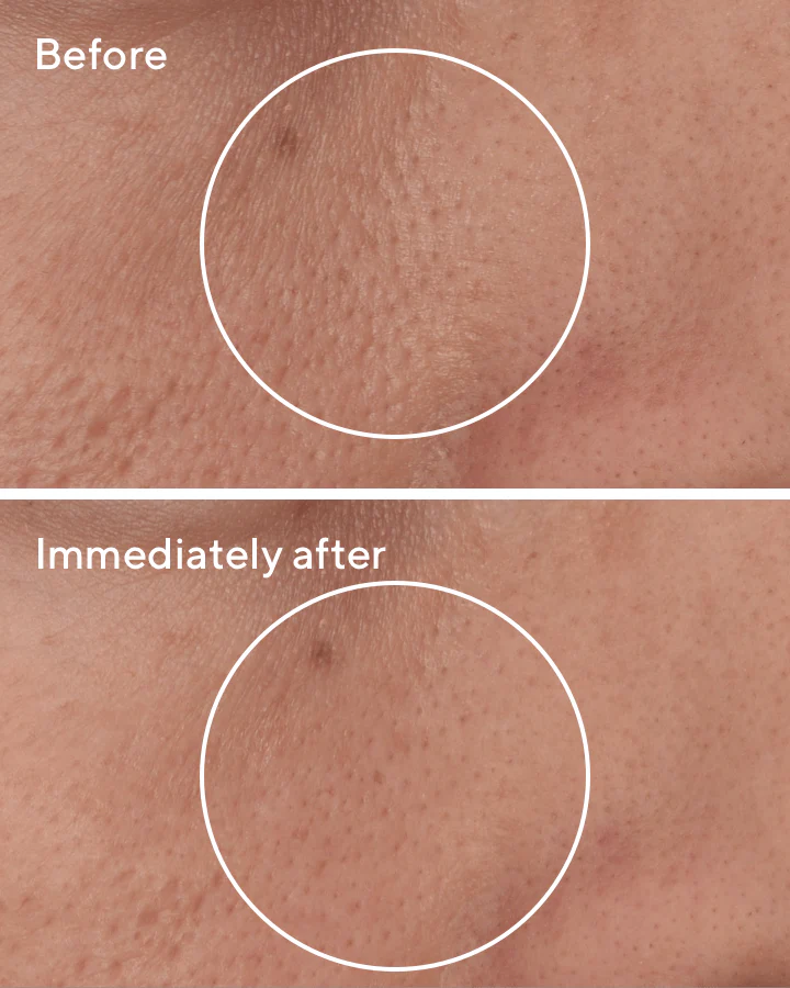 Targeted Pore Corrector - Image 5