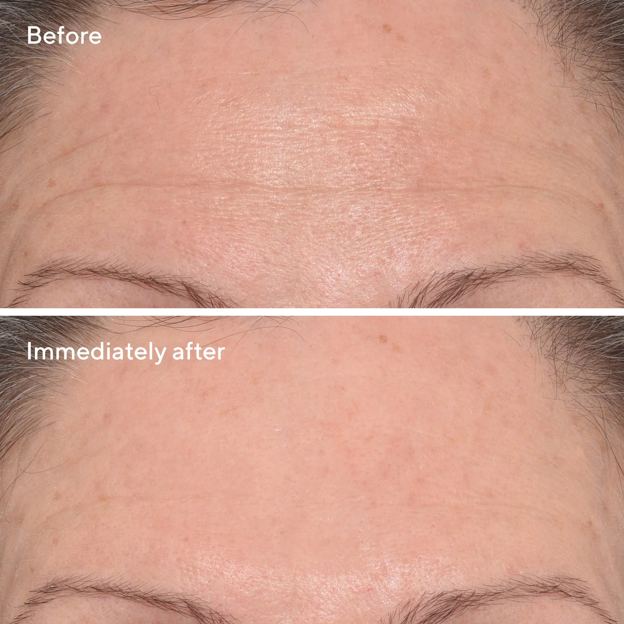 Targeted Wrinkle Corrector - Image 4